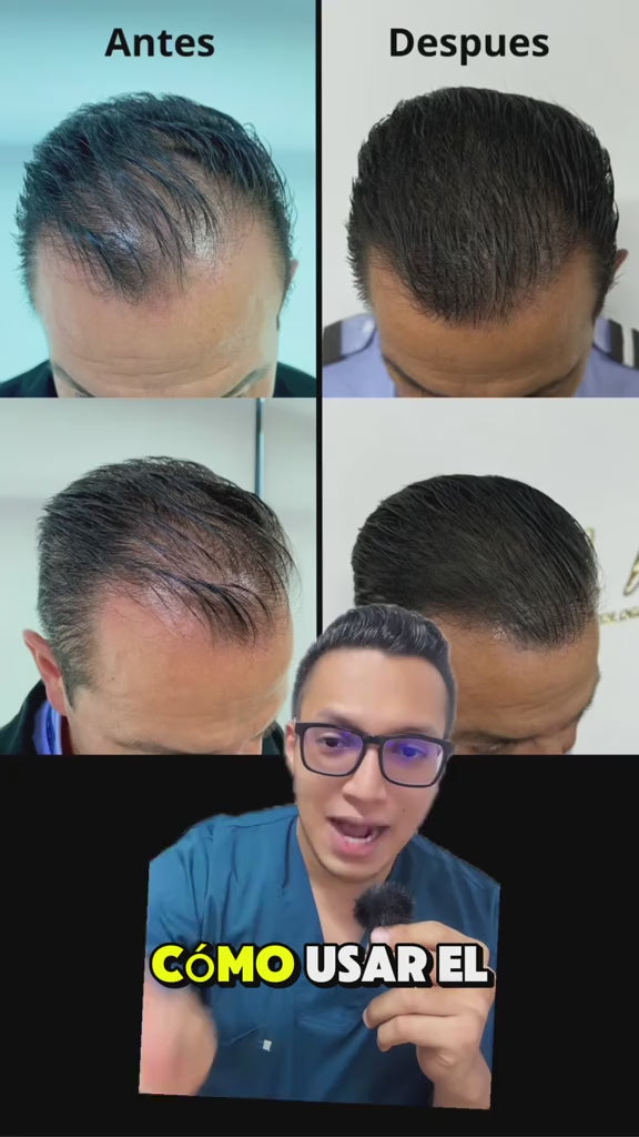 Cargar video: 
